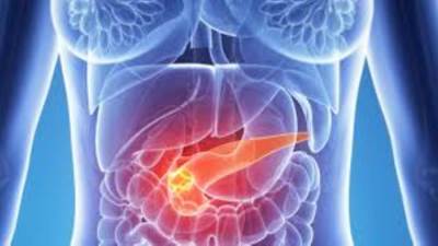 دراسة: آلام الظهر قد تكون العلامة الأولى لسرطان البنكرياس