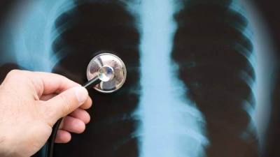 معهد أمصال الهند يطلق اللقاح الأول للالتهاب الرئوى .. إليك التفاصيل