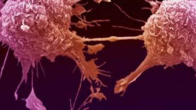 متى يصبح العرق إشارة الاصابه بمرض السرطان