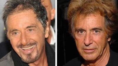 6 نجوم عالميين مشهورين بالشعر المستعار.. تعرف عليهم