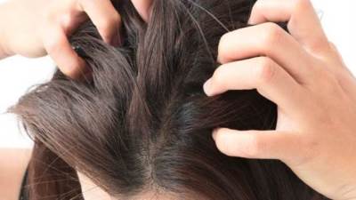 أهم الوصفات المنزلية الرائعة لعلاج حكة الرأس
