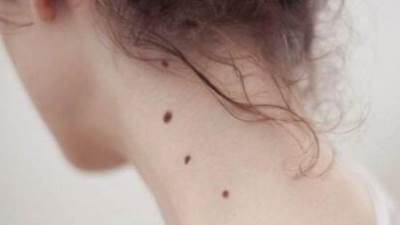 أخيرًا.. أسباب ظهور الشامات أو الوحمات في أماكن الجسم المختلفة