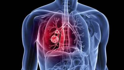 دراسة بريطانية تكشف تأثير فيروس كورونا علي الرئة طوال العمر