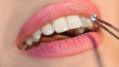 "مجوهرات الأسنان" موضة صيف 2021