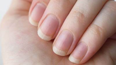 دراسة: الإصابة بكورونا تؤدي إلى تغيرات في الأظافر
