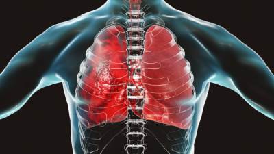 هذا مايحدث لـ الرئة عند الإصابة بكورونا بعد تلقى اللقاح!