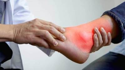 أعراض زيادة الأملاح في الجسم .. تعرف عليها