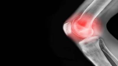 مشروب يقلل أعراض التهاب المفاصل المؤلم .. احرص على تناوله