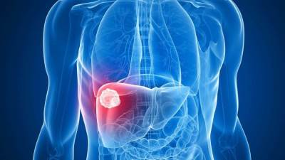 أعراض سرطان الكبد عديدة .. تعرفى عليها