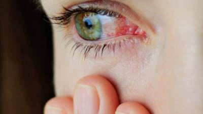 4 مشاكل صحية قد تعانى منها العين فى فصل الشتاء .. تعرفي عليها