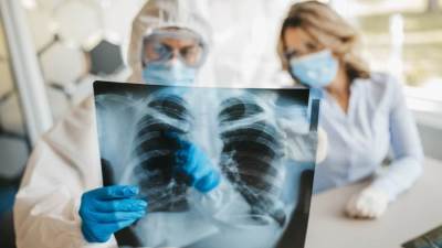 دراسة توضح تأثير فيروس كورونا على الرئة