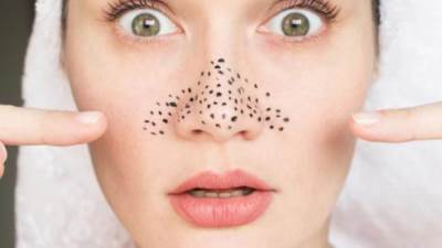 كيف تعالجي البثور السوداء في المنزل بالعسل؟