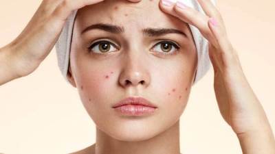 كيف تقللي من الإصابة بالحبوب في 10 خطوات فقط؟