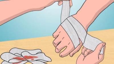 كيفية علاج حروق الماء المغلي في المنزل 