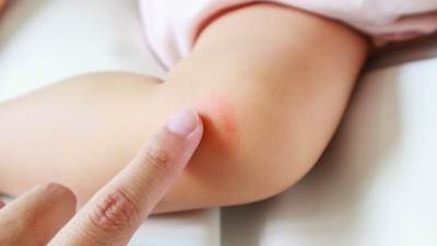 لن تصدق.. الصابون يجذب البعوض!