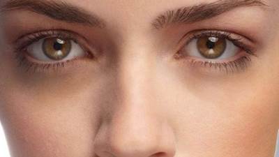 10 عناصر غذائية تكافح الهالات السوداء تحت العينين