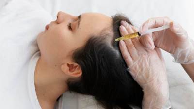 فيلر الشعر.. وكل ما تريدين معرفته عنه