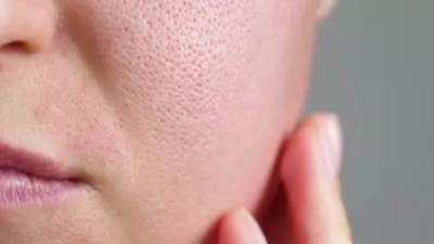 أفضل علاجات لعلاج مسام البشرة الواسعة