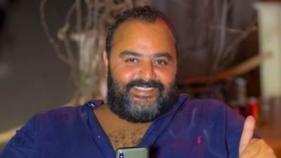 شيكو يكشف تفاصيل خضوعه لعملية جراحية