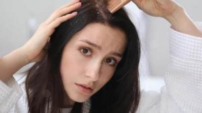 زيوت نباتية تخلصكِ من قشرة الشعر