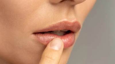 تخلصي من تشقق الشفاه في الشتاء بطرق فعالة